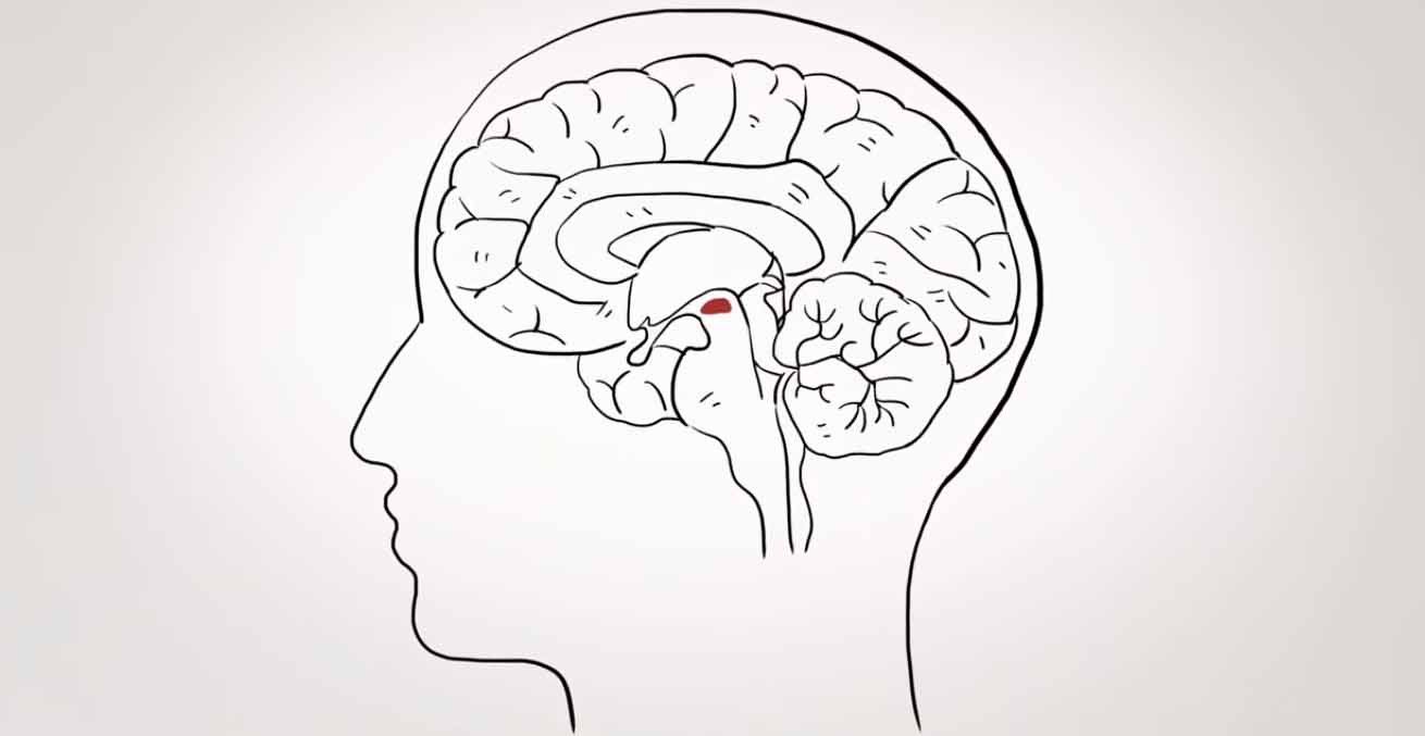 पार्किन्सन रोग दूर करने के 3 चरण Cure of Parkinson Disease in Hindi Parkinson's disease