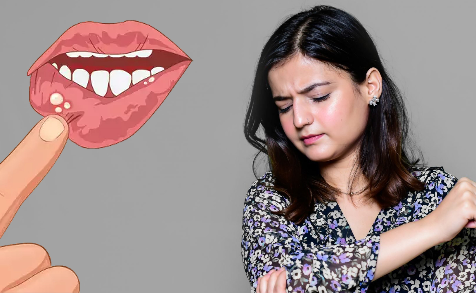 मुंह में छाले ठीक करने के लिए घरेलू नुस्खे | muh ke chhale kaise thik kare in hindi मुंह में छाले ठीक करने के लिए घरेलू नुस्खे