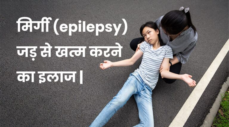epilepsy Treatment Hindi
