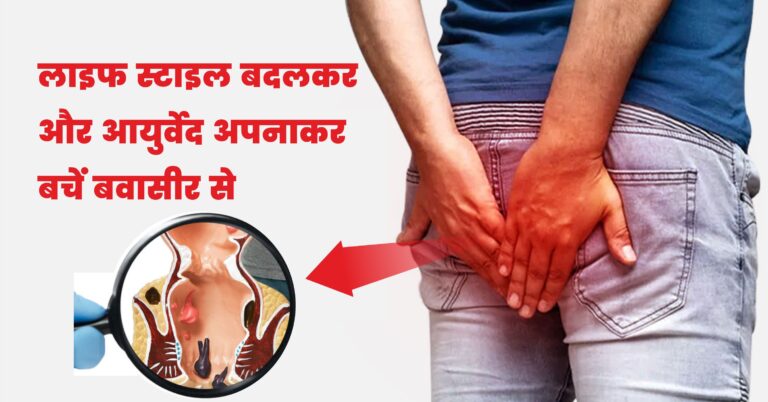 इस लेख में हम बवासीर के लक्षण, कारण और आयुर्वेदिक घरेलू इलाज से संबंधित सभी बिंदुओं पर विस्तार से चर्चा करेंगे।